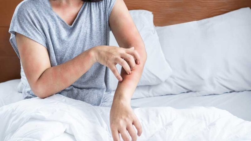 Milben im Haushalt – wo sie leben und wie du sie loswirst
